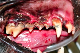gum disease1